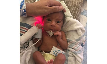 NICU patient