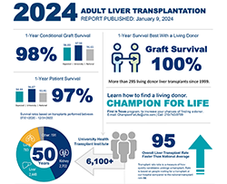 Liver Transplant Outcomes Infographic