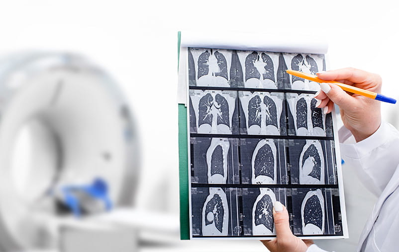 CT scan images of lungs.