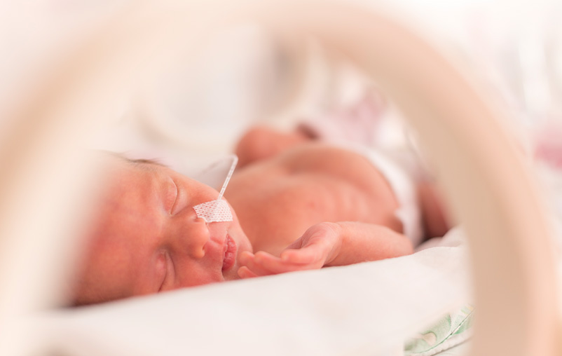 Wear the Gown: What Parents Should Know When Having a Premature Baby ...