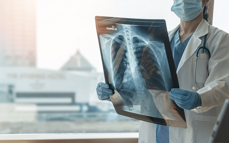 Doctor review x-ray of lungs 